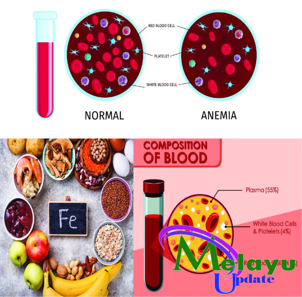 Makanan Untuk Penderita Anemia - Melayupdate