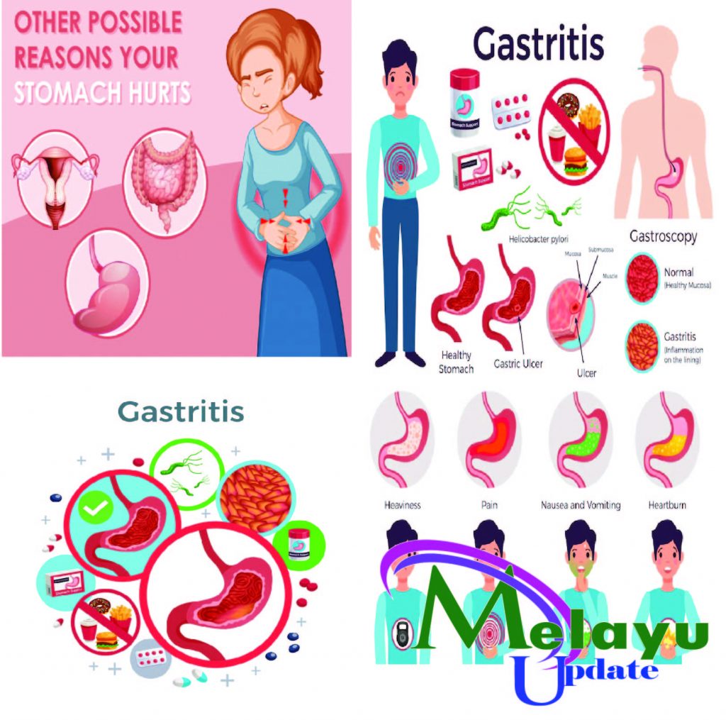 menjaga kesehatan lambung - Melayupdate